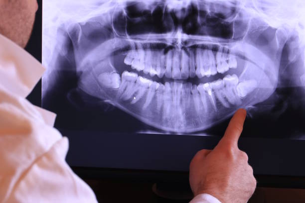 Best Orthodontic Emergency Dentist in Mattydale, NY